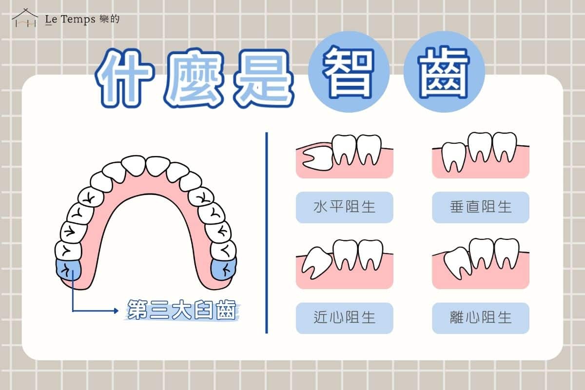 智齒有哪些